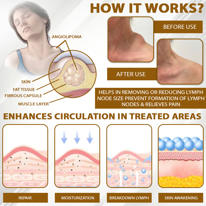 NeutralCare™ SwellingCare ApisVenom Cream Roller
