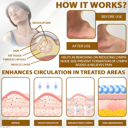 NeutralCare™ SwellingCare ApisVenom Cream Roller
