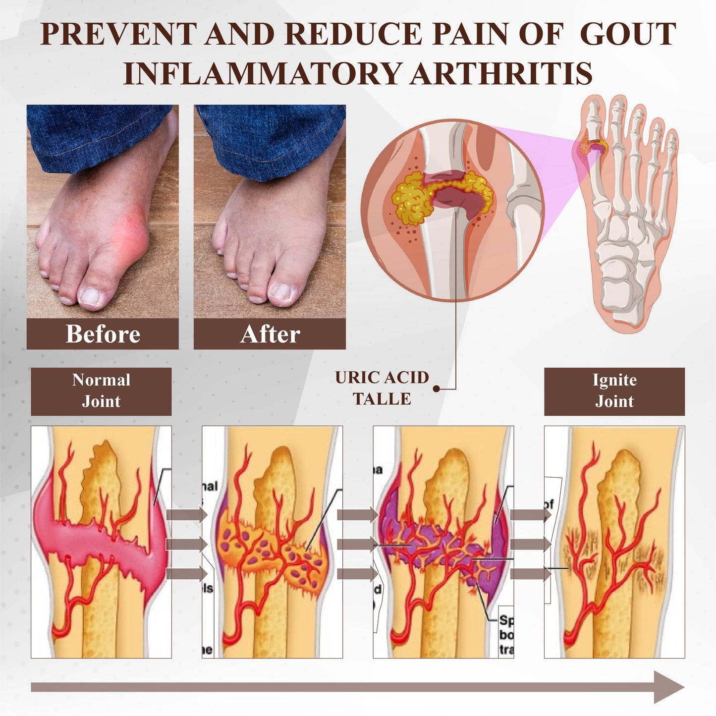 NeutralCare™ Emu Oil Turmeric Bone Sooth Gel