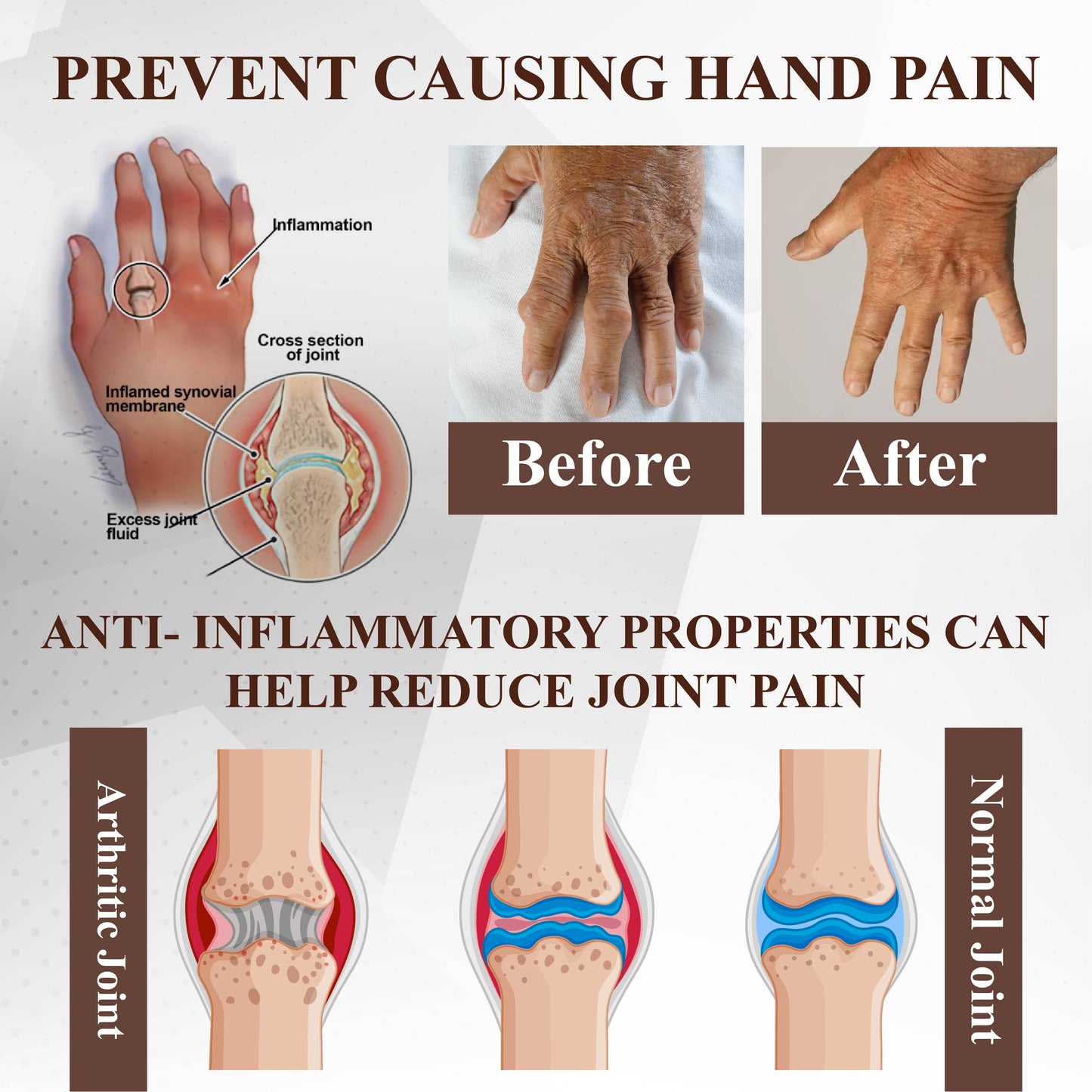 NeutralCare™ Emu Oil Turmeric Bone Sooth Gel