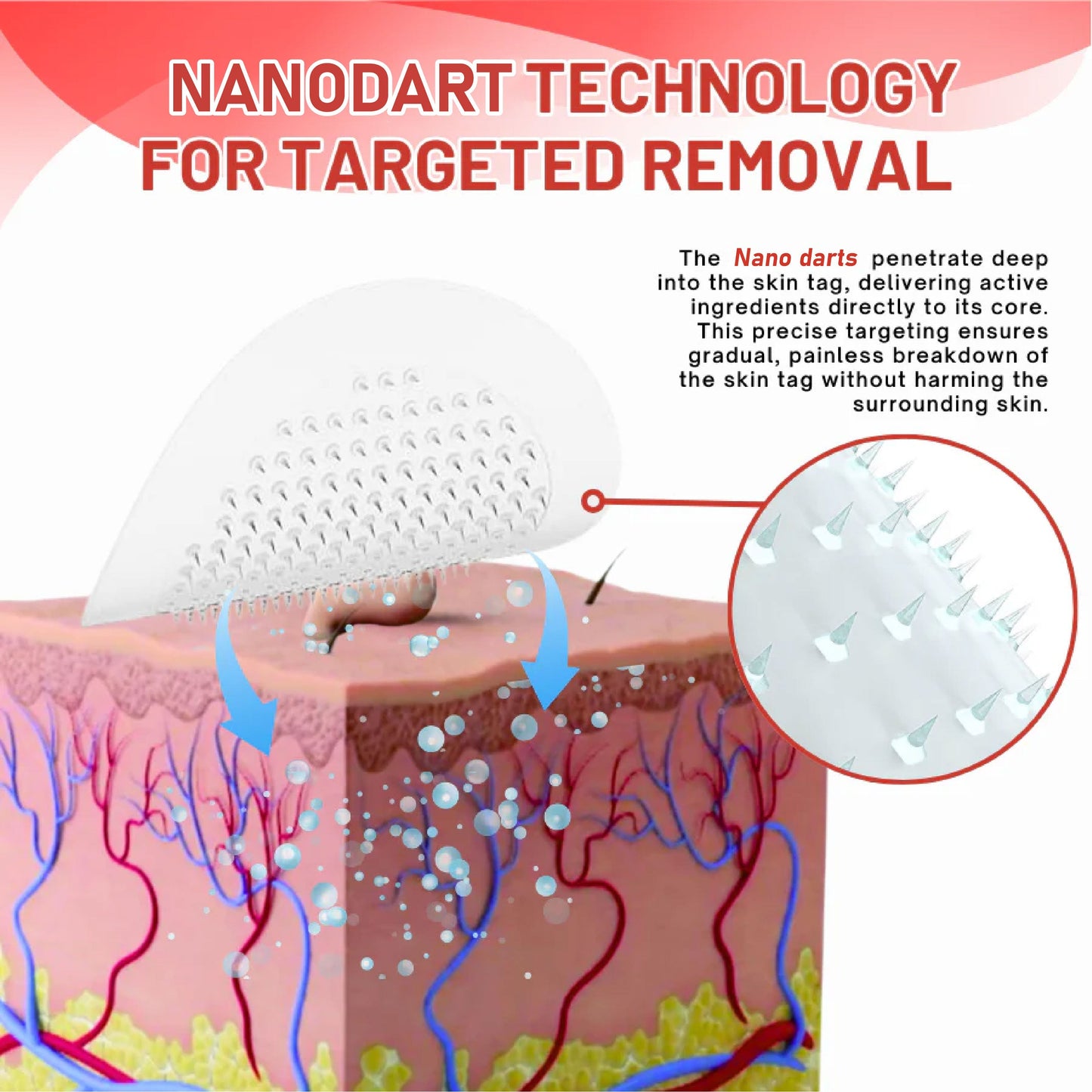 NeutralCare™ NanoDart Skin Tag Removal Patches