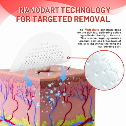 NeutralCare™ NanoDart Skin Tag Removal Patches