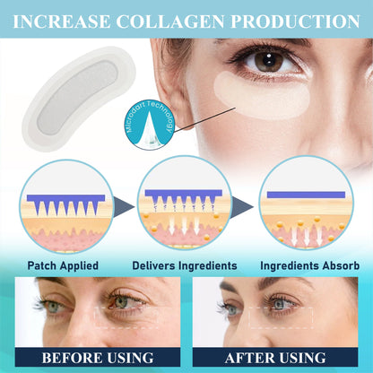 NeutralCare™ EyeRenew Microneedle Intensive Patch