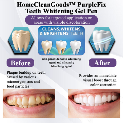 NeutralCare™ PurpleFix Teeth Whitening Gel Pen