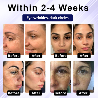 NeutralCare™ RadiantPro Retinol Eye Cream Stick