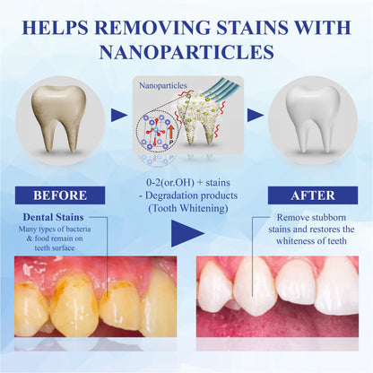 NeutralCare™ SmilePolish Nano Teeth Stain Cleaner